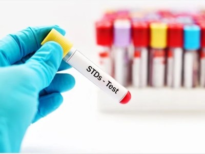  STD Testing in Singapore – A Comprehensive&nbsp;Guide